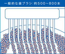 一般的な歯ブラシ｜【症例】知覚過敏の症状に対する治療 ｜センター南の歯医者「センター南デンタルクリニック」