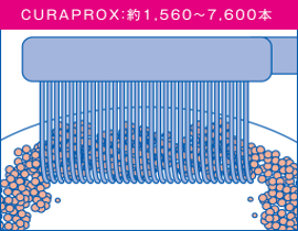 CURAPROXの歯ブラシ｜【症例】知覚過敏の症状に対する治療 ｜センター南の歯医者「センター南デンタルクリニック」