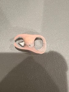 義歯の裏|【症例】抜歯してから時間が経過し、被せ物と義歯で修 復した治療|センター南の歯医者「センター南デンタルクリニック」